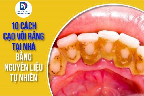 cách cạo vôi răng tại nhà bằng nguyên liệu tự nhiên